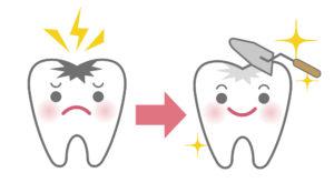 歯 の ひび 再 石灰 化